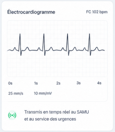 Électrocardiogramme transmis en temps réel au SAMU et aux urgences